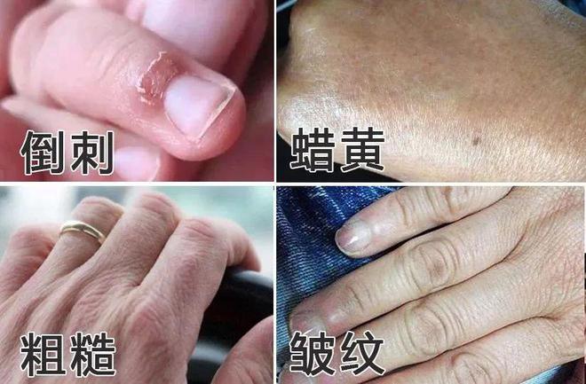 霜！跪求你买这8支好用到想报警！九游会j9登陆冬日的第一支护手(图3)