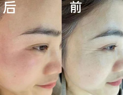 品有哪些？2024高性价比产品分享j9九游会(中国)网站抗皱纹的护肤(图4)
